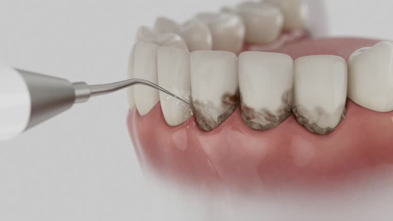 Trusted Tooth Extraction service in Selma, NC - Dentist Open Now
